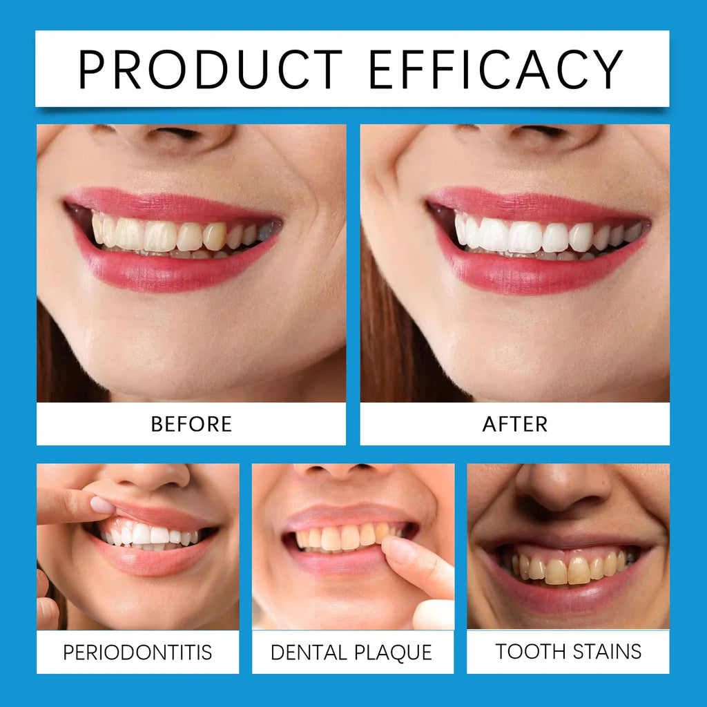 Achieve a Radiant Smile with Our Professional Teeth Whitening LED Light Kit - Includes 4X Whitening Gel for Fast Results!