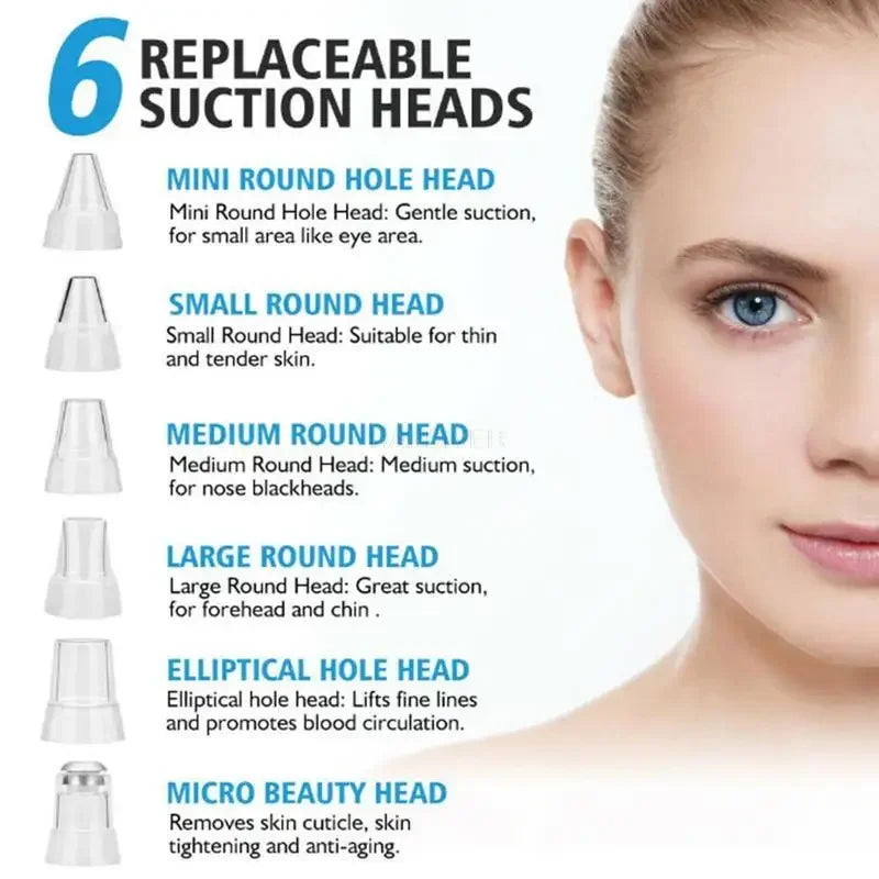 Revitalize Your Skin with the USB Charging Face Pore Vacuum: Ultimate Blackhead & Acne Remover for Deep Cleansing and Flawless Skin