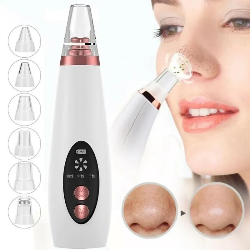 Revitalize Your Skin with the USB Charging Face Pore Vacuum: Ultimate Blackhead & Acne Remover for Deep Cleansing and Flawless Skin