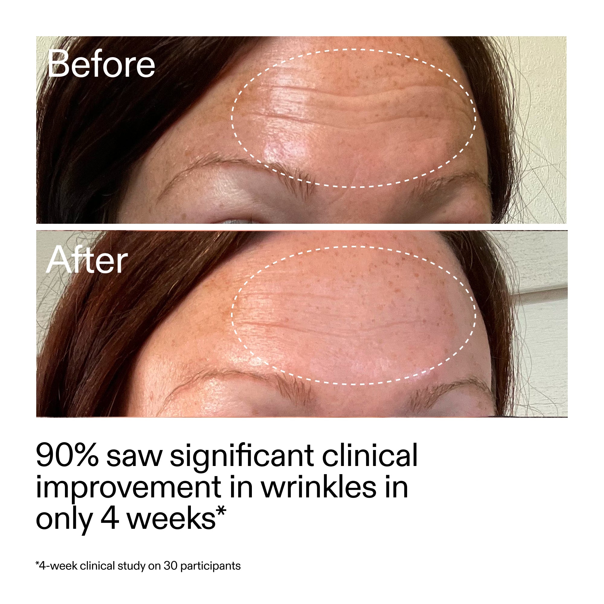 Revitalize Your Skin with Our Gentle Starter Retinol Serum for Smooth, Youthful Complexion