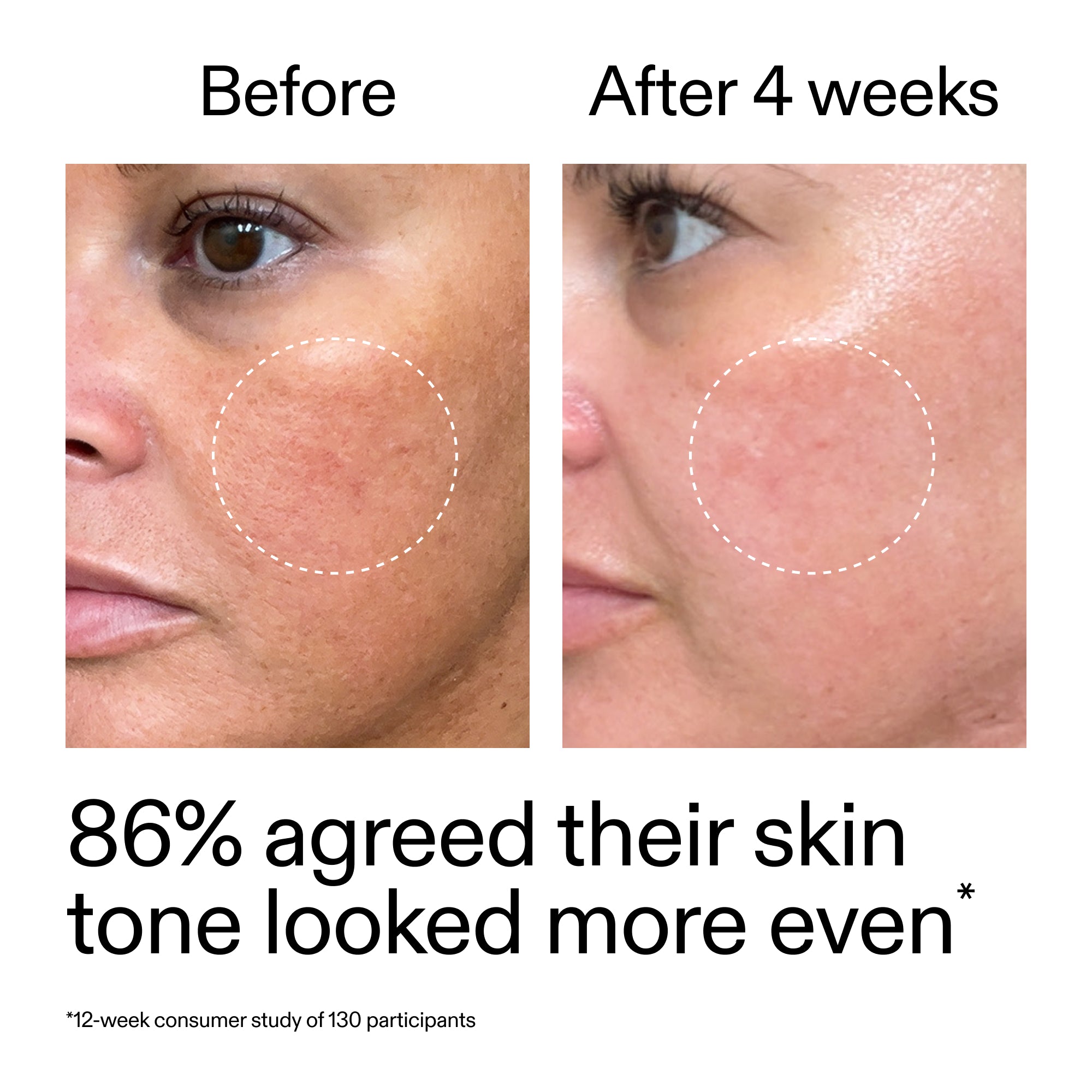 Revitalize Your Skin with Our Gentle Starter Retinol Serum for Smooth, Youthful Complexion