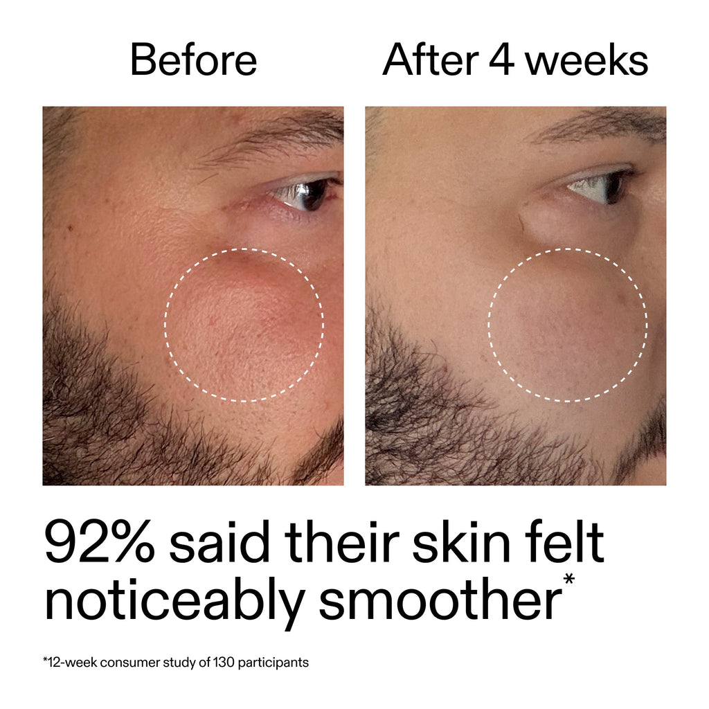 Revitalize Your Skin with Our Gentle Starter Retinol Serum for Smooth, Youthful Complexion